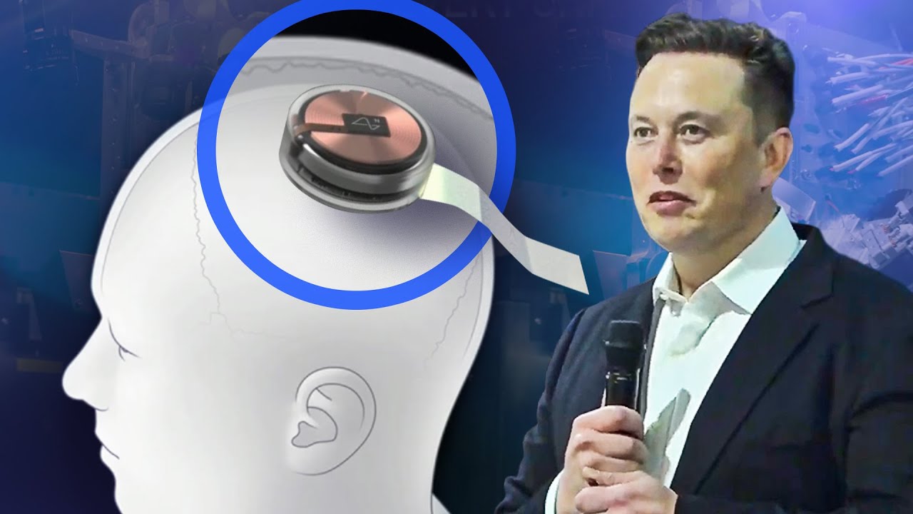 Ông trùm công nghệ Elon Musk: Loài người sẽ được cấy chip não Neuralink vào năm tới - Elon Musk 1