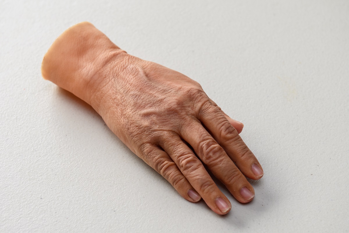 TVT Medical làm chủ được nguyên liệu silicone y tế trong nước - tin vui cho người khuyết tật muốn phục hình thẩm mỹ - TVT ban tay tham my44