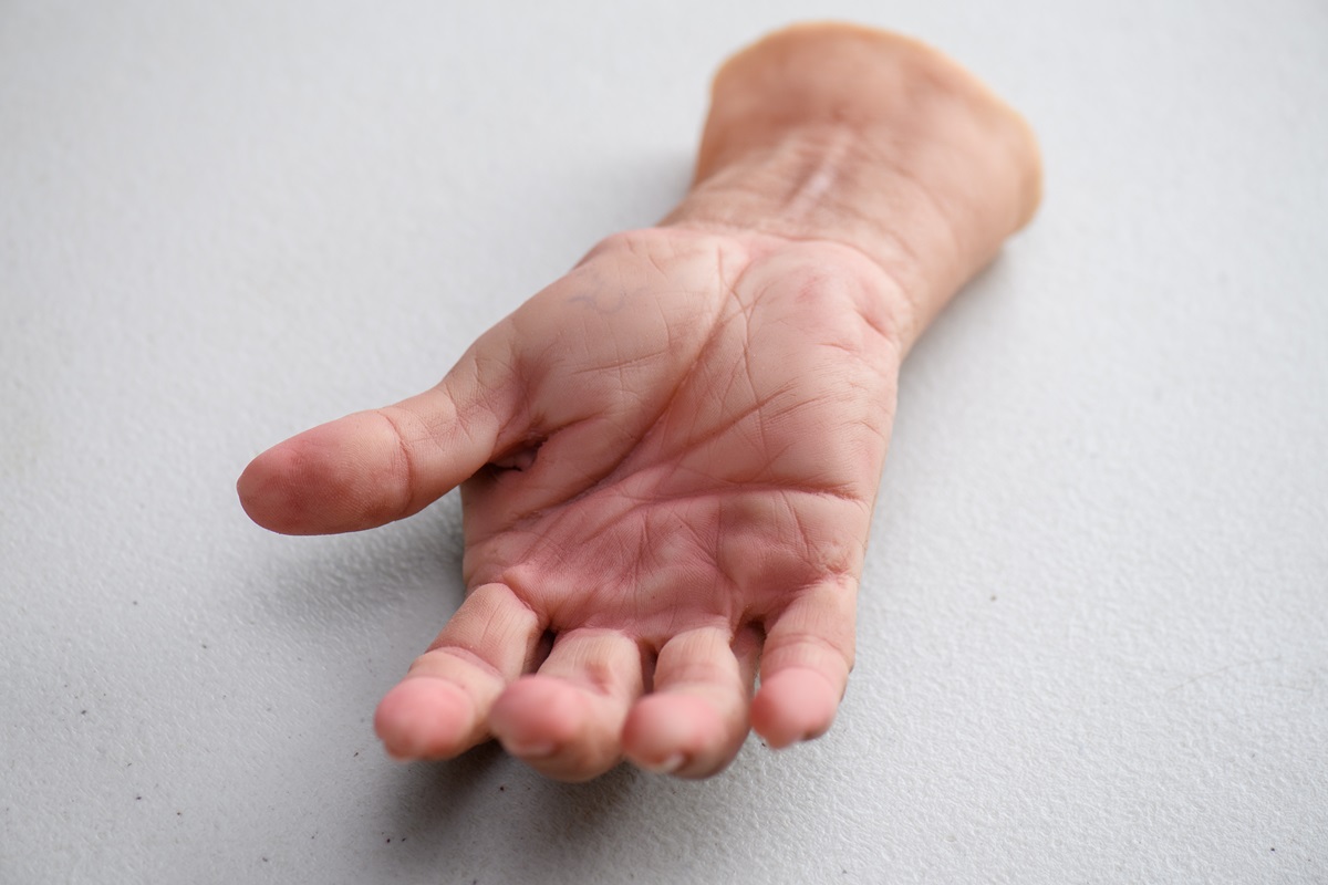 TVT Medical làm chủ được nguyên liệu silicone y tế trong nước - tin vui cho người khuyết tật muốn phục hình thẩm mỹ - TVT ban tay tham my68