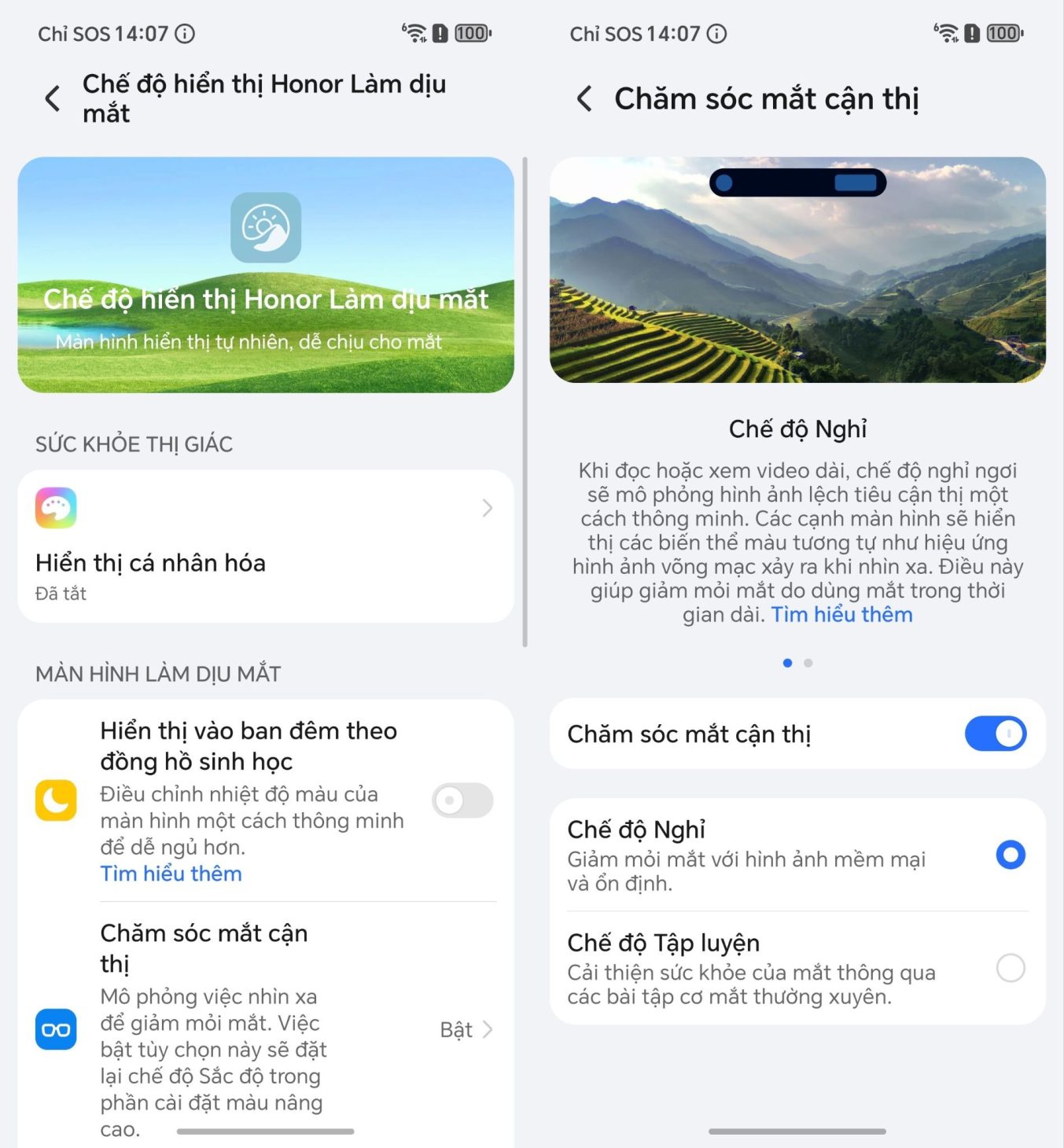 HONOR 600 giải thành công bài toán cận cao cấp, camera 200MP và loạt tính năng AI phục vụ sát nhu cầu người sáng tạo 5 HONOR 600 giải thành công bài toán cận cao cấp, camera 200MP và loạt tính năng AI phục vụ sát nhu cầu người sáng tạo - image 63